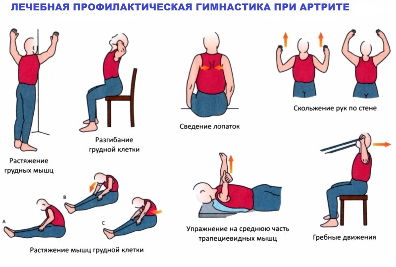 ЛФК