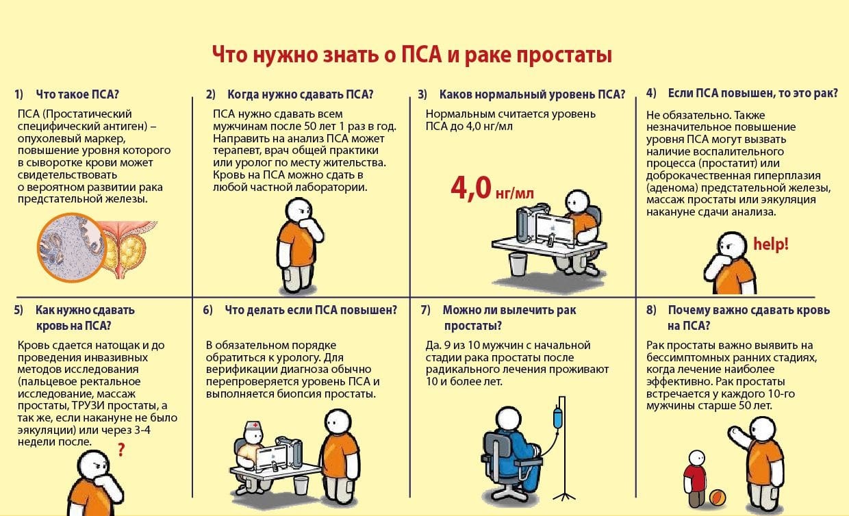 Важные сведения об анализе ПСА